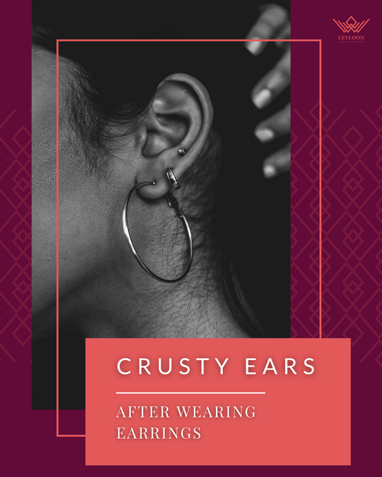 CRUSTY EARS AFTER WEARING EARRINGS